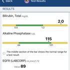 Need help determining what’s going or interested if anyone has had similar experience