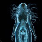 Radiographs of Mythological Creatures (FAILS)